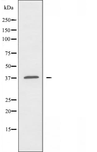 Alpha4GnT / A4GNT Antibody