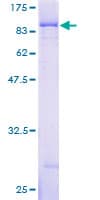 Human IMP-3 / IGF2BP3 Protein (Recombinant GST)