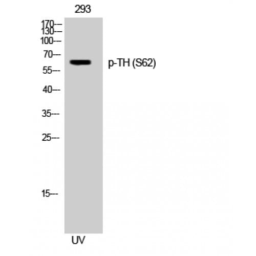 Polyclonal Rabbit anti-Human TH / Tyrosine Hydroxylase Antibody (10-90 aa, IHC, WB)