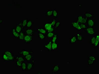 IHC-plus™ SEPP1 / Selenoprotein P Antibody