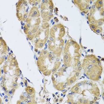 CAMK2G / CaMK II Gamma Antibody