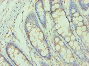 SMYD3 Antibody (aa199-428)