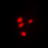 CREB1 / CREB Antibody (Internal)
