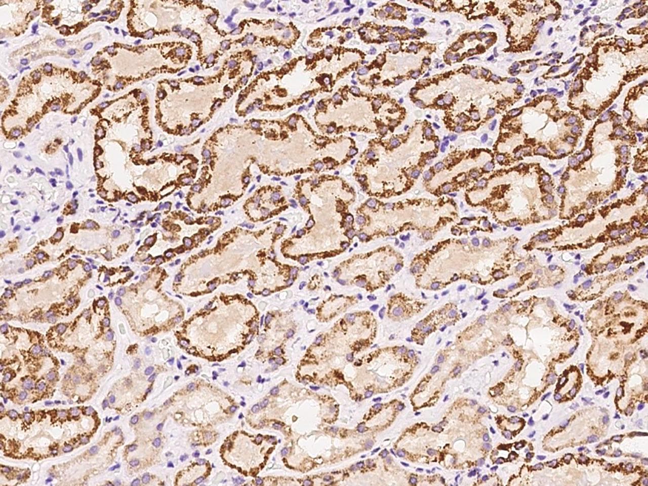 HSDL2 Antibody