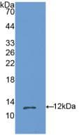 OSM / Oncostatin M Antibody (aa25-115, APC)