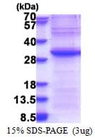 Human EXOSC4 / RRP41 Protein (Recombinant His)
