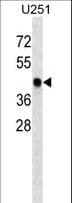 SNX6 Antibody