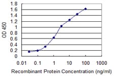 ADCYAP1R1 / PAC1 Receptor Antibody (clone 2B12)
