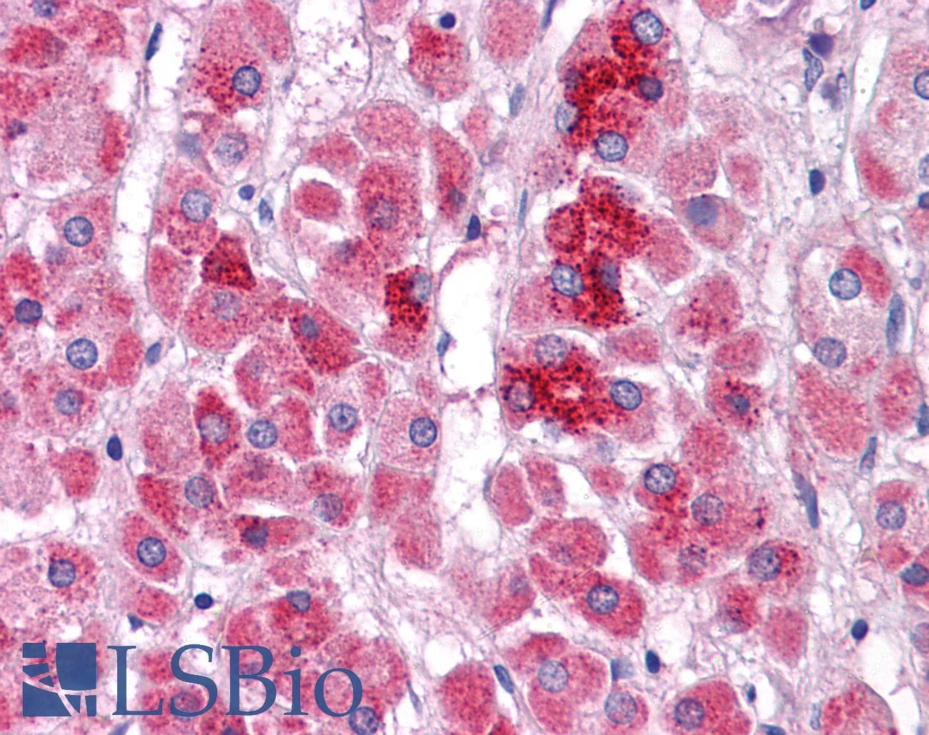 IHC-plus™ NAA40 Antibody