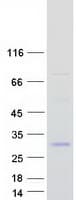 Human C1QG / Complement C1QC Protein (Recombinant Myc-DDK (Flag))