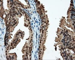 CELF1 / CUGBP1 Antibody (clone OTI5B8)