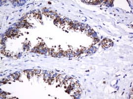 GLB1 / Beta-Galactosidase Antibody (clone OTI1C9)