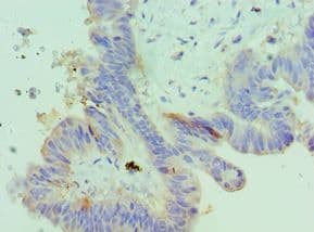 Polyclonal Rabbit anti-Human IGFBP4 Antibody (aa22-258, IHC)