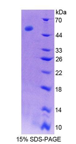 Rat Antithrombin Protein (Recombinant His-T7)