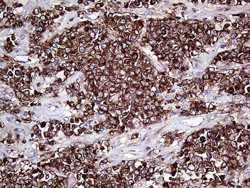 CD79B / CD79 Beta Antibody (clone OTI2B6)