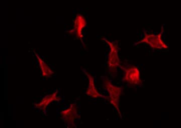 Polyclonal Rabbit anti-Human CAMK2A / CaMKII Alpha Antibody (IHC, IF, WB)