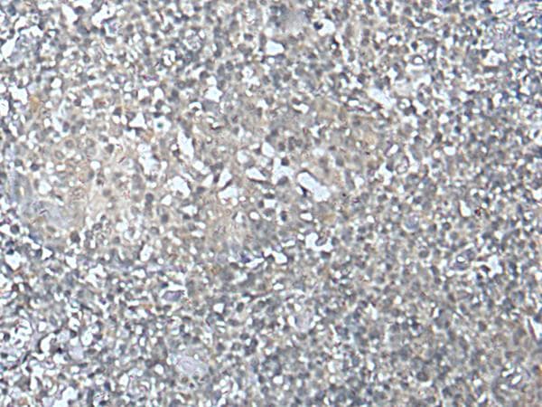 Polyclonal Rabbit anti-Human MEF2D Antibody (IHC)