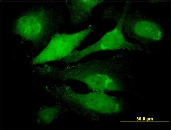 IHC-plus™ RNF144B Antibody (clone 4F1)