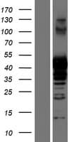 PRMT1 Protein (Over-Expression Lysate Myc-DDK (Flag))