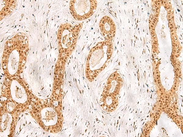 RPS27A Antibody