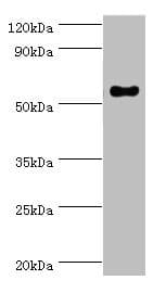 CD119 / IFNGR1 Antibody (aa270-489)