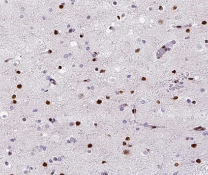 Polyclonal Rabbit anti-Human POLB / DNA Polymerase Beta Antibody (IHC, IF, WB)