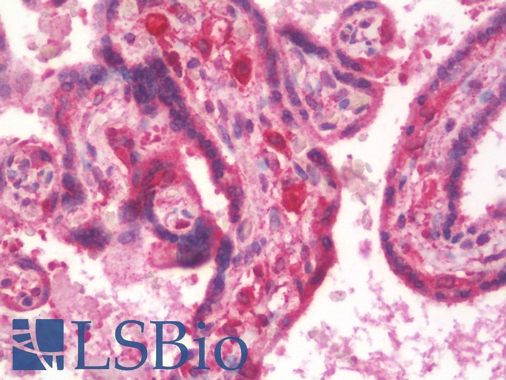 IHC-plus™ HIF2A / EPAS1 Antibody (clone EP190b)