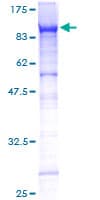 Human CD105 Protein (Recombinant GST)