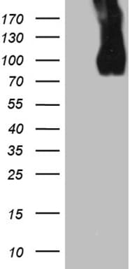 LAMP1 / CD107a Antibody (aa29-382, clone OTI1C5)