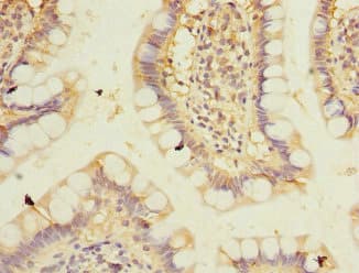 Polyclonal Rabbit anti-Human PPM1D / WIP1 Antibody (IHC, WB)