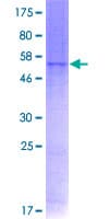 Human P2RY6 / P2Y6 Protein (Recombinant GST)