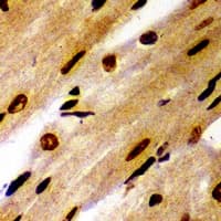 Polyclonal Rabbit anti-Human PSMB1 Antibody (IHC, IF, WB)