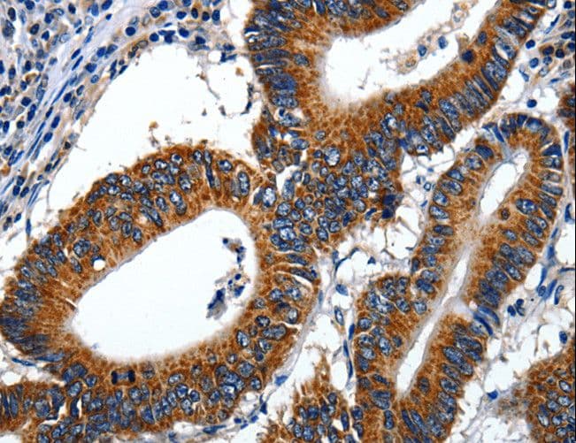 LAMA1 / Laminin Alpha 1 Antibody