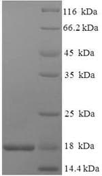 Dog NPC2 Protein (Recombinant 6His-SUMO, N-terminus)