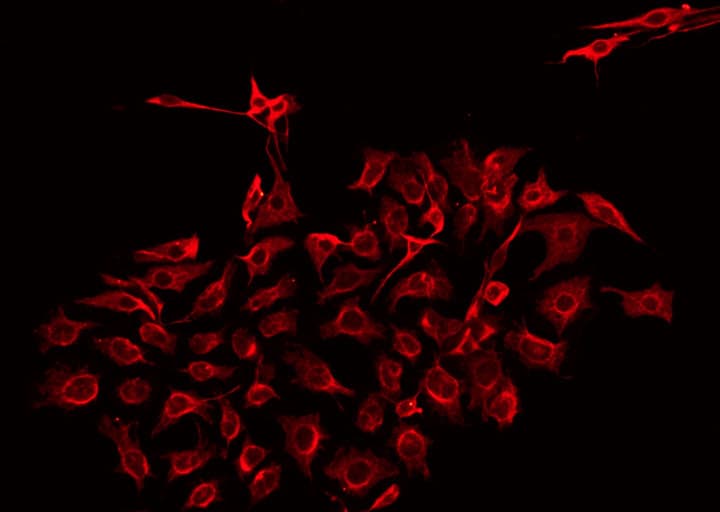NMU / Neuromedin U Antibody