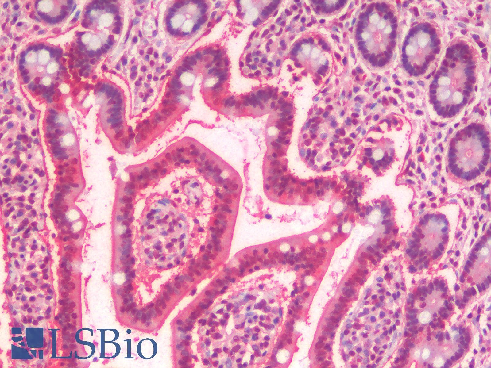 IHC-plus™ Polyclonal Rabbit anti-Human SLC5A4 / SGLT3 Antibody (C-Terminus, IHC)
