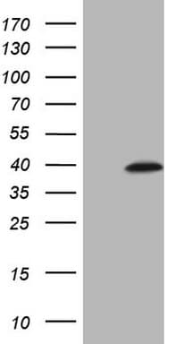 MAGEB3 Antibody (clone OTI1D3)