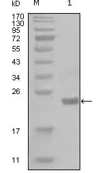 Monoclonal Mouse anti-Human CHUK / IKKA / IKK Alpha Antibody (clone 7C10B6, WB)