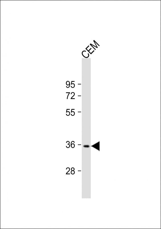 RNF126 Antibody (aa84-115)
