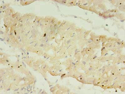 ATP2A2 / SERCA2 Antibody