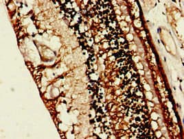 RLBP1 / CRALBP Antibody