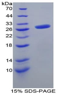 Mouse FGF23 Protein (Recombinant His-T7)