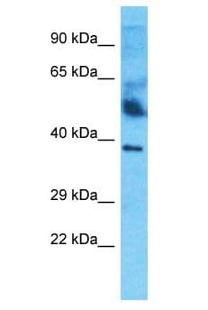 HPR Antibody (aa208-257)