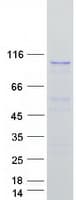 Human COPB1 / Beta-COP Protein (Recombinant Myc-DDK (Flag))