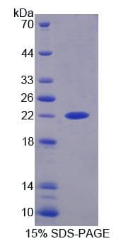 Human ERCC6 / CSB Protein (Recombinant His, N-Terminal)