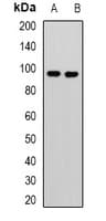 Polyclonal Rabbit anti-Human KANSL3 Antibody (WB)