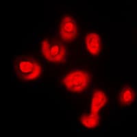 DUSP16 / MKP7 Antibody (C-Terminus)