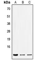 SEC61B Antibody (Internal)