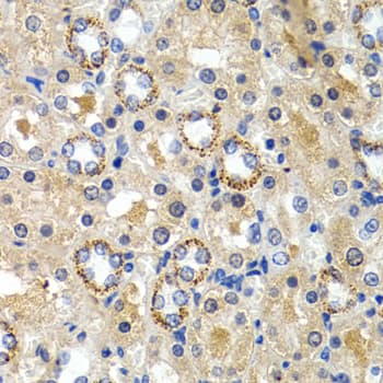 CYP24 / CYP24A1 Antibody
