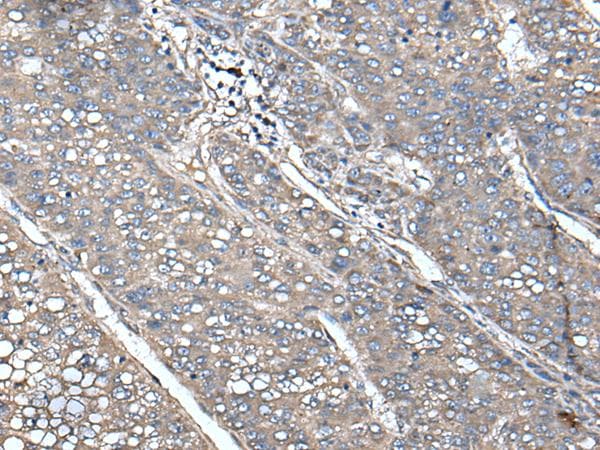 UNC13B Antibody